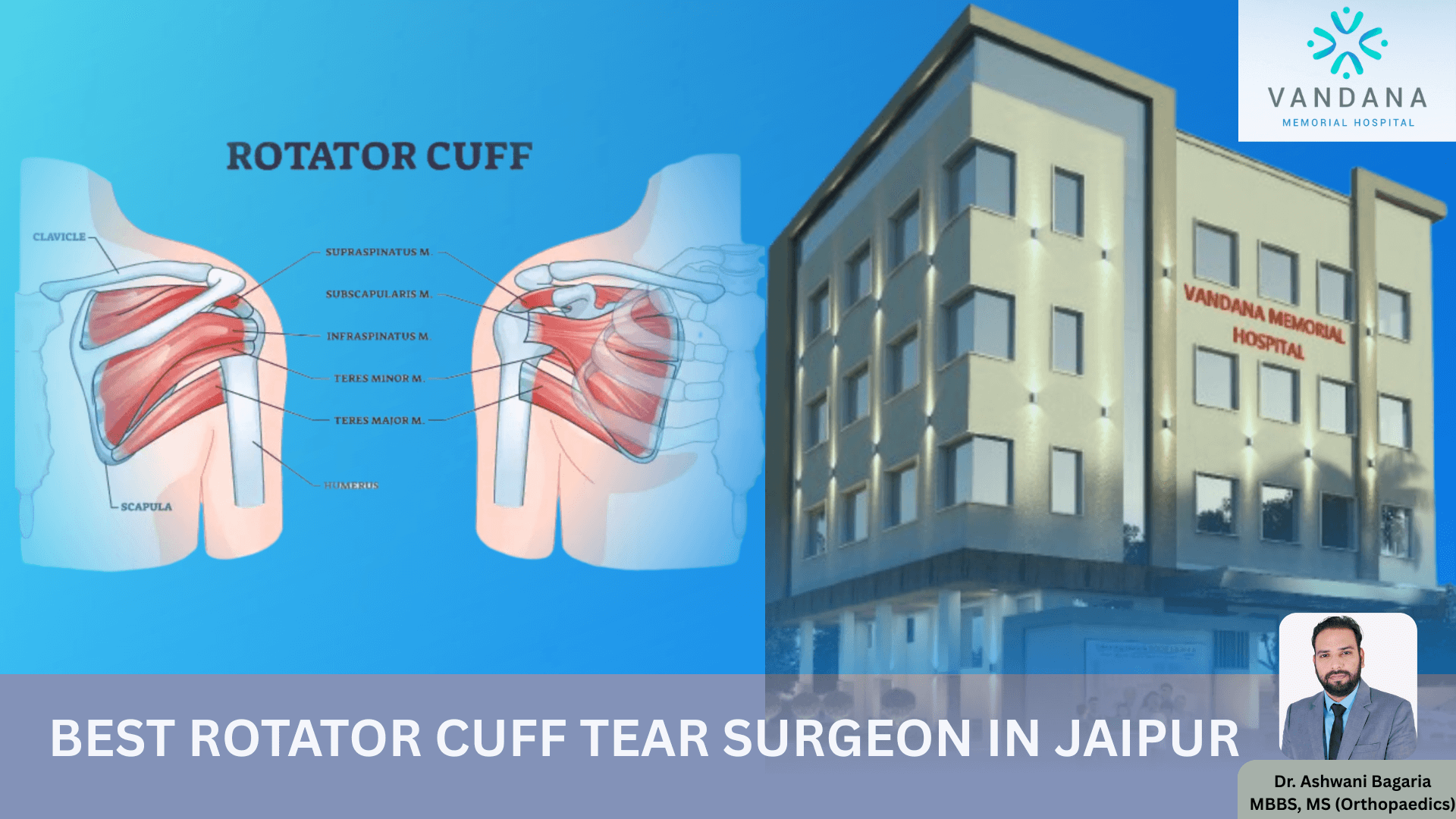 best-rotator-cuff-tear-surgeon
