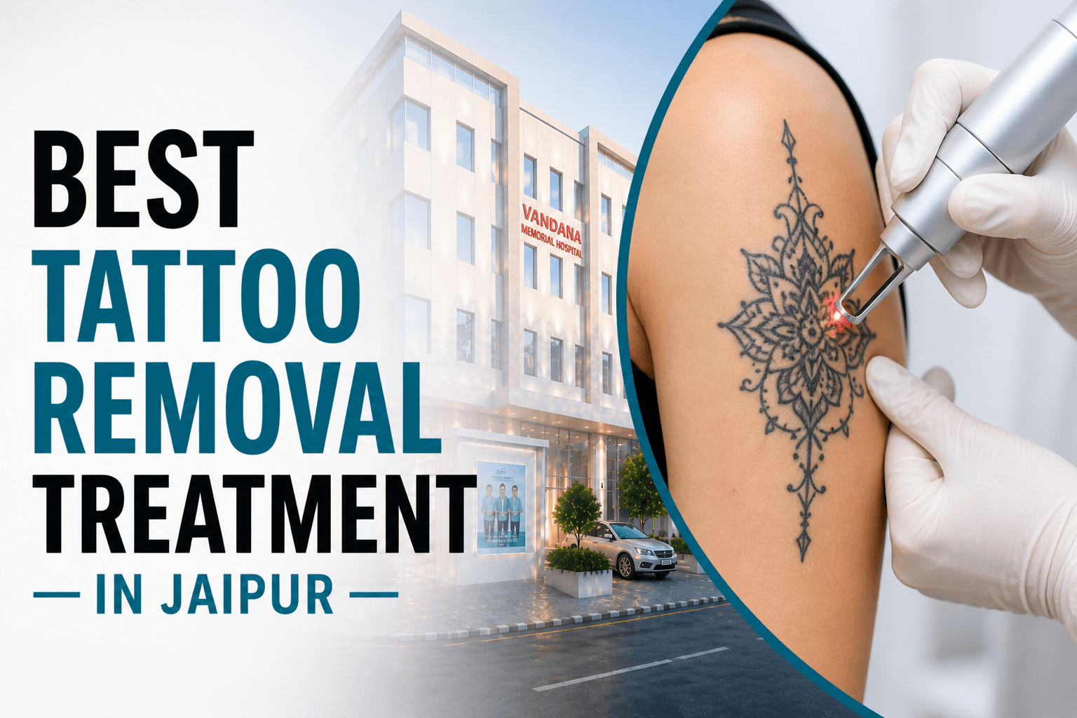 Best Tattoo Removal Treatment in Jaipur