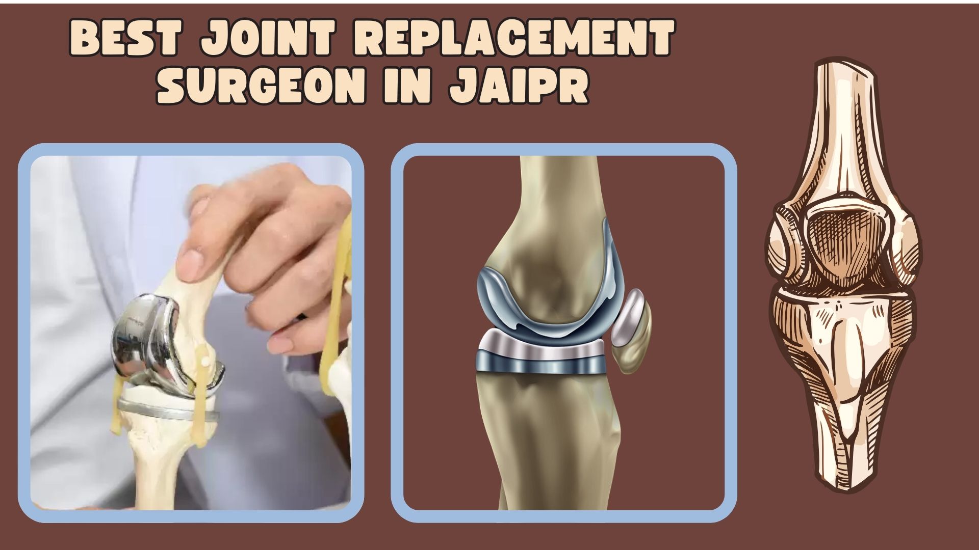 innar-Joint-Replacement-Surgeon