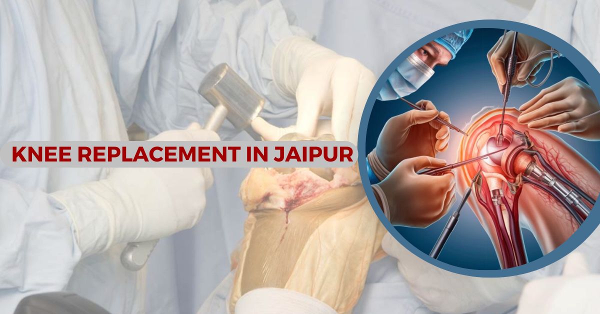 Best Filler Treatment in Jaipur