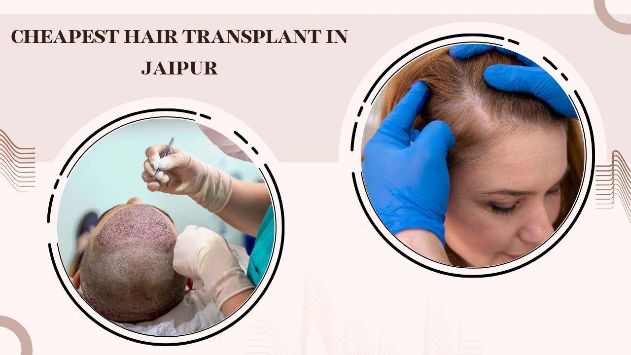 Cheapest Hair Transplant in Jaipur