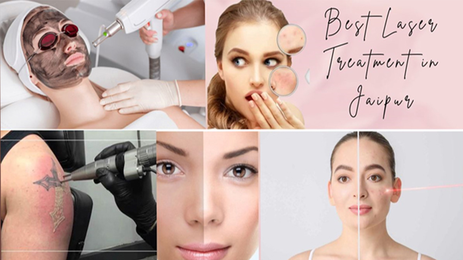 Best Laser Treatment in Jaipur