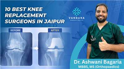 10 Best Knee Replacement Surgeons in Jaipur