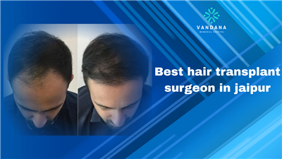 Top Reasons to Consult the Best Hair Transplant Surgeon in Jaipur
