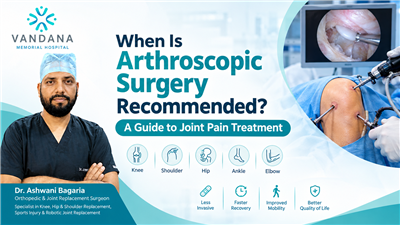When Is Arthroscopic Surgery Recommended? A Guide to Joint Pain Treatment